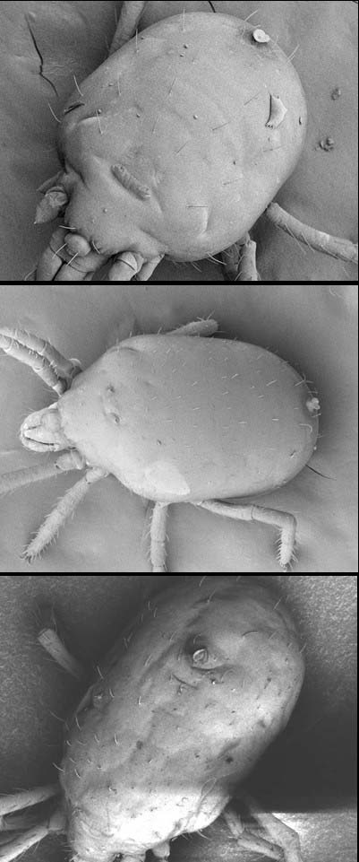 Very close, high resolution, scanning electron microscope images in black and white of three species of blue oat mites; (a) Penthaleus major (b) Penthaleus falcatus and (c) Penthaleus tectus