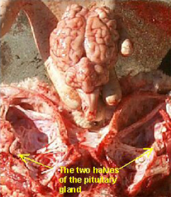 The two halves of the pituitary gland
