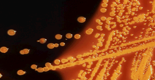 Microscopic view of E. coli bacteria