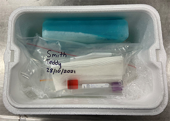 Labelled blood tubes with paper towel in initial ziplock bag. Secondary ziplock bag labelled with owners surname, animal ID and sample date. Secondary ziplock bag in styrofoam esky with bubble wrap and ice brick.