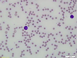 Bovine blood smear showing piroplasms in erythrocytes