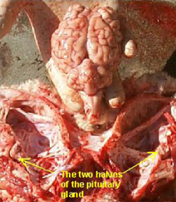 Figure 9 The two halves of the pituitary gland