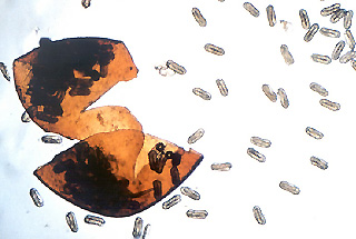 PCN cyst crushed open to reveal hundreds of eggs